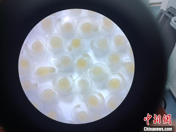 图为显微镜下的鱼卵。　青海湖裸鲤救护中心 供图
